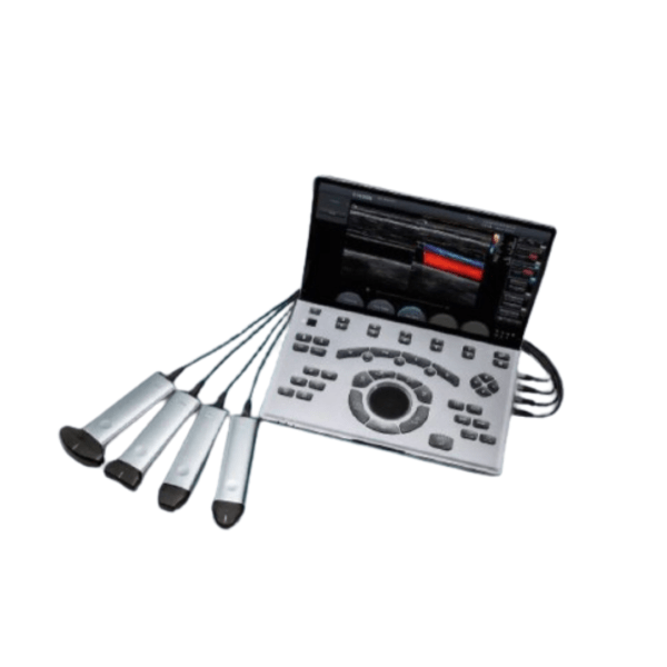 CHISON SONOAIR 30 ULTRASOUND